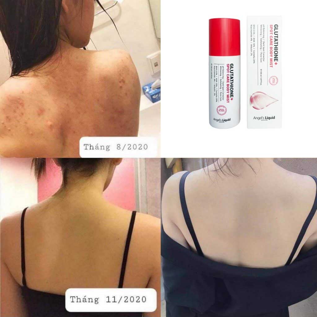 Angel's Liquid Glutathione rv