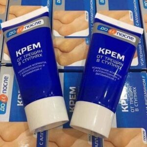 Kem trị nứt gót chân Kpem của Nga