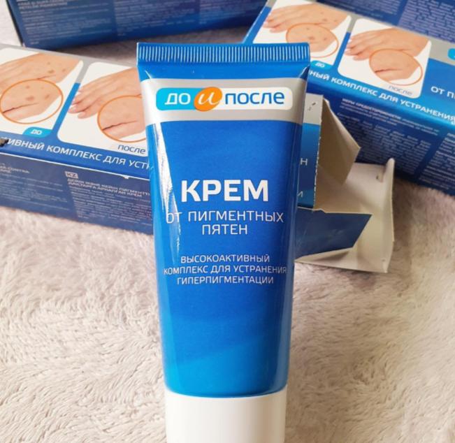 Kem Kpem trị đồi mồi có tốt không?