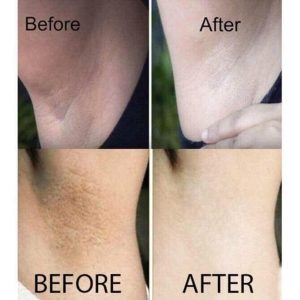 Review của khách hàng về Nuwhite H6