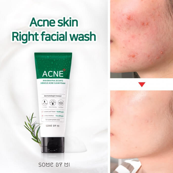 Sữa rửa mặt Some By Mi AHA-BHA-PHA 30 Days Miracle Acne 100ml