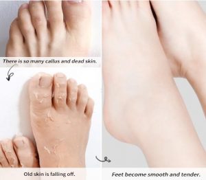 Những câu hỏi thường gặp về túi ủ chân Mino