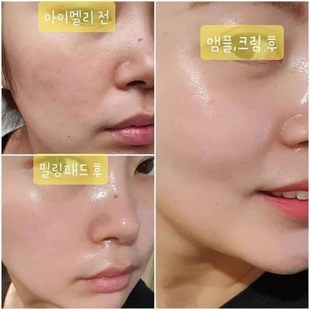 Tinh chất JM Collagen Multi Vita Capsule Ampoule REVIEW