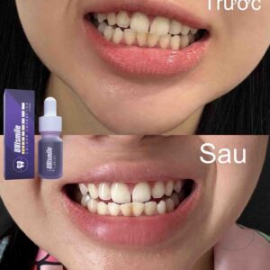 Serum Trắng Răng Unismile Hỗ Trợ Vết Ố ...