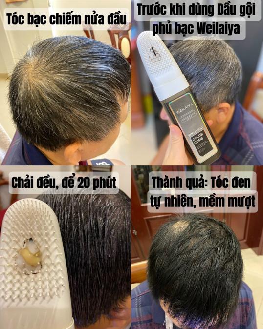 dầu gội thảo dược đen tóc Weilaiya 