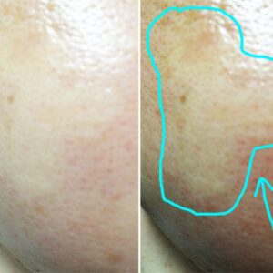 Nước hoa hồng CC Melano Lotion