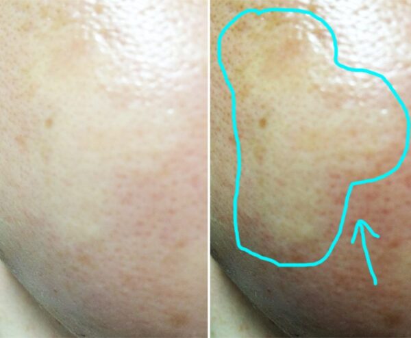Nước hoa hồng CC Melano Lotion