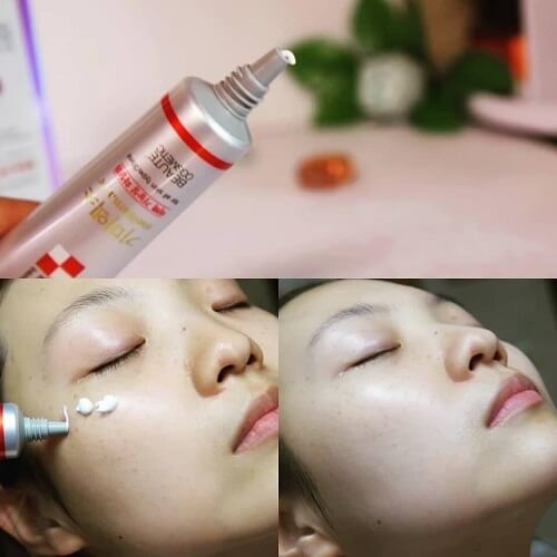 Công dụng kem trị nám 3D Whitening Clinic Cream Melasma Hàn Quốc