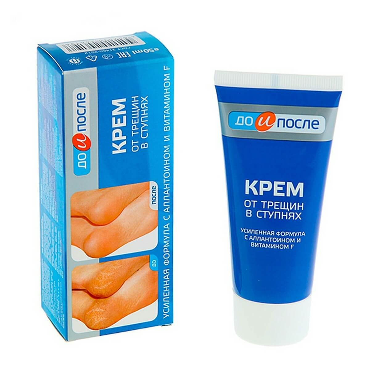 Review kem trị nứt gót chân Kpem