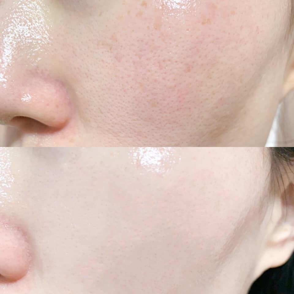 pure retinol high class moist essence cách sử dụng