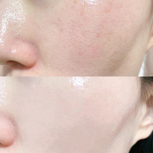 Serum Pure Retinol High Class Moist Essence Ngăn ...
