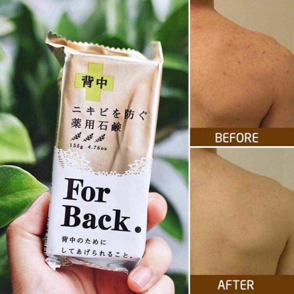 Xà phòng For Back Medicated Soap trị mụn lư...
